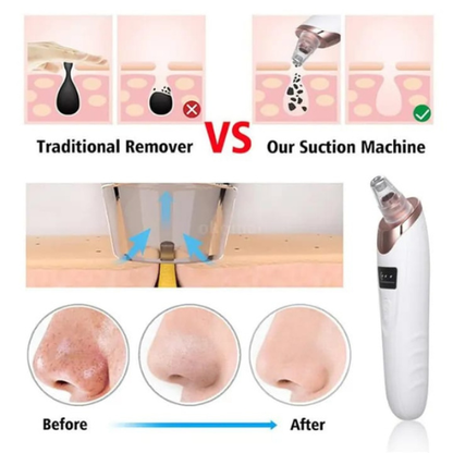 Electric Face Vacuum Blackhead & Pore Cleaner — Deep Cleansing Tool for Nose & Face